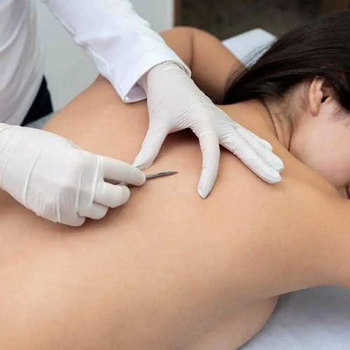 SBH_Body Treatments