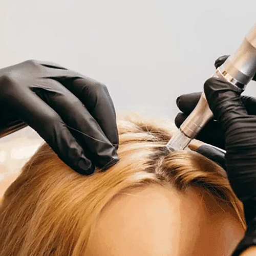 hair restoration image